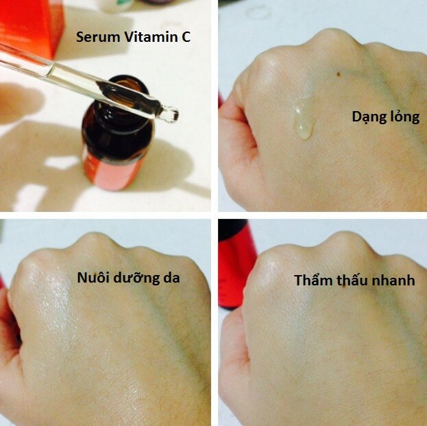 Serum vitamin C là gì