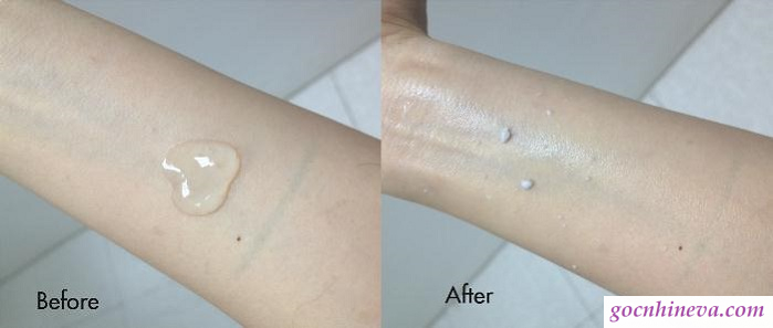  trước và sau khi sử dụng gel tẩy tế bào chết Spa