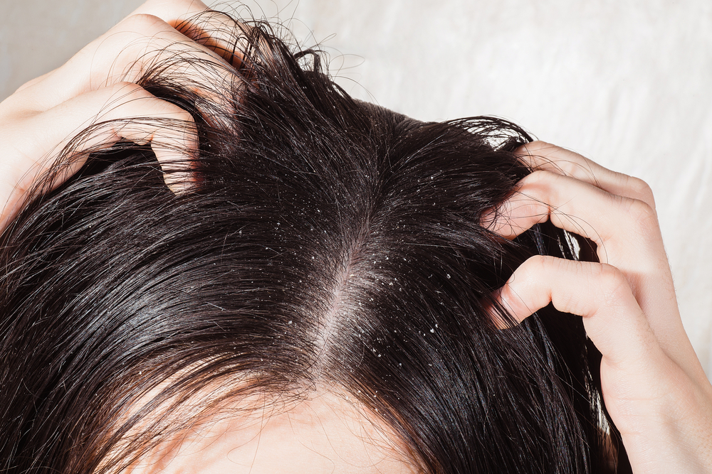 Sai lầm hàng ngày khiến tóc bạn ngày càng yếu và gãy rụng! Cẩn thận nếu không muốn tóc ngày một ít đi