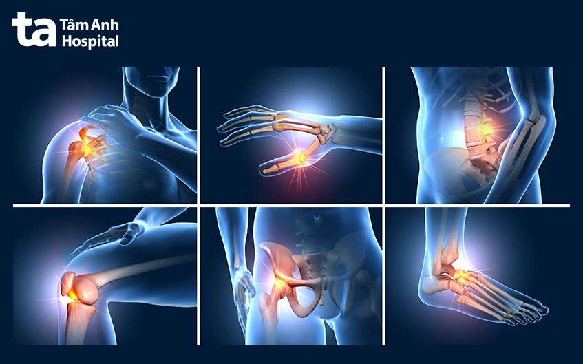 Cartilage Là Gì: Chức Năng, Sự Thoái Hóa Và Cách Tái Tạo Hiệu Quả