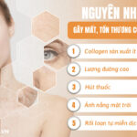 Collagen Revitalization Là Gì? Tầm Quan Trọng Của Collagen Trong Trẻ Hóa Da