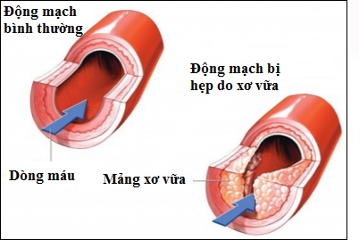 Plaque Là Gì? Tìm Hiểu Mảng Bám, Sâu Răng Và Vệ Sinh Răng Miệng