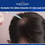 Rogaine Là Gì? Khám Phá Hiệu Quả Và Cách Sử Dụng Điều Trị Rụng Tóc