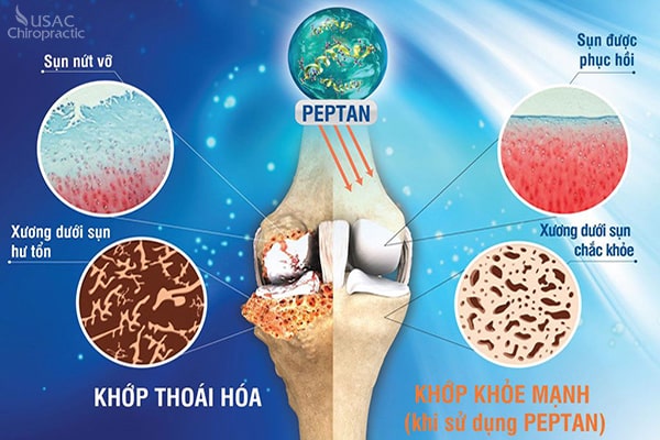 Tinh Chất Peptan Là Gì: Lợi Ích, Thành Phần Và Công Dụng Cho Sức Khỏe