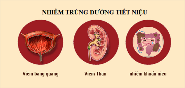 Biến Chứng Có Thể Xảy Ra Khi Bị Nhiễm Khuẩn Tiết Niệu